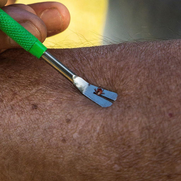 TickCheck Premium Tick Remover Kit