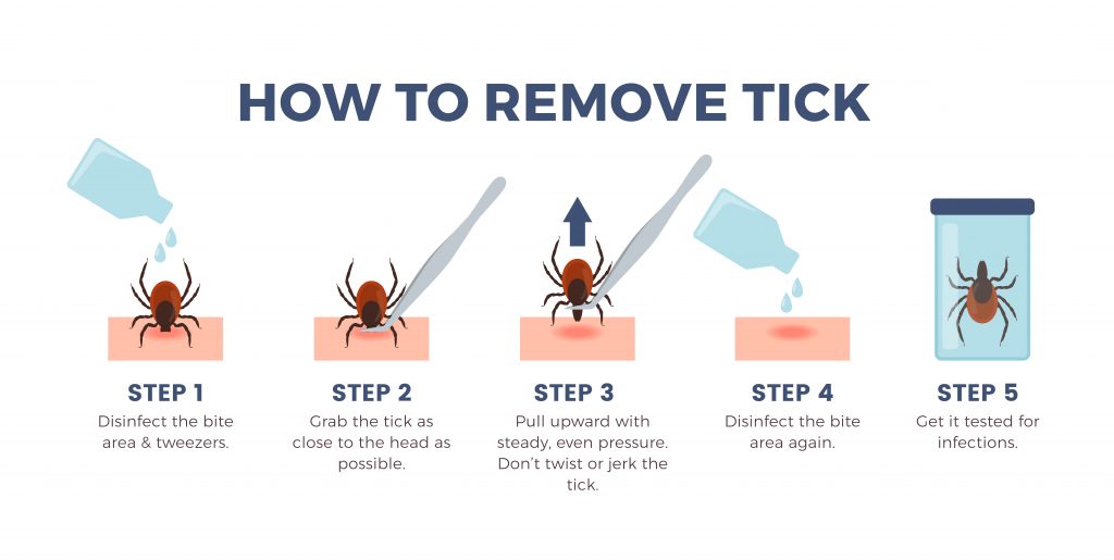Image is showing the proper steps to removing a tick.